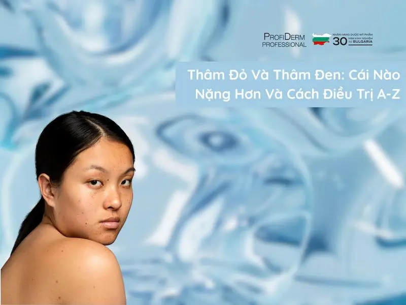 thâm đỏ và thâm đen cái nào nặng hơn