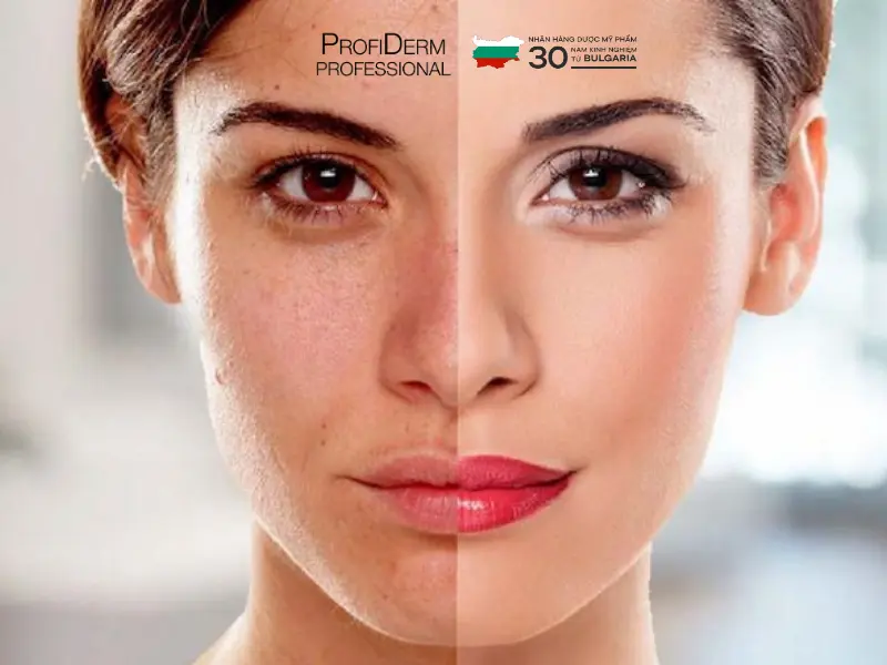 phục hồi da sau treatment