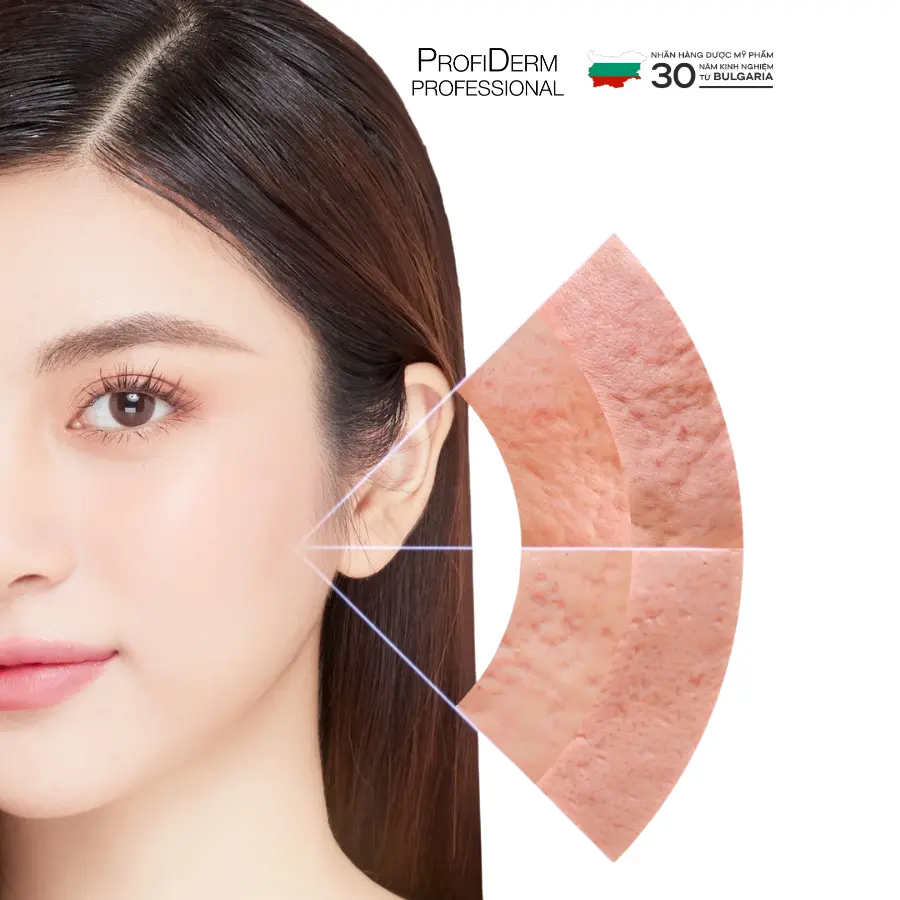 nguyên nhân giãn mao mạch ở mặt