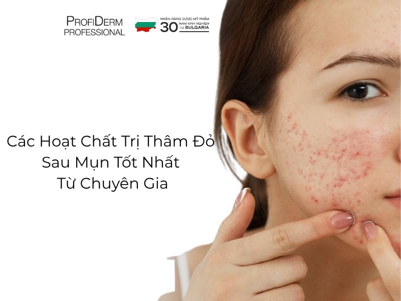 Các Hoạt Chất Trị Thâm Đỏ Sau Mụn Tốt Nhất Từ Chuyên Gia
