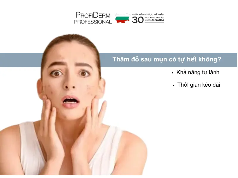 Thâm đỏ sau mụn có tự hết không? Thâm đỏ sau mụn có tự hết không?