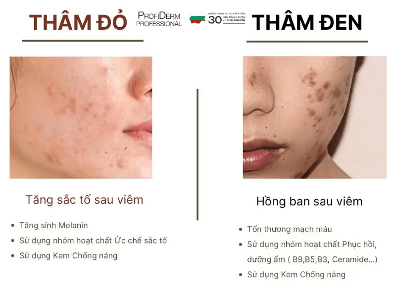 các hoạt chất trị thâm đỏ