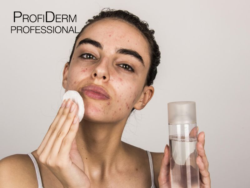 7 Cách Giúp Vết Thương Mụn Mau Lành, Giảm Thâm Sẹo Hiệu Quả