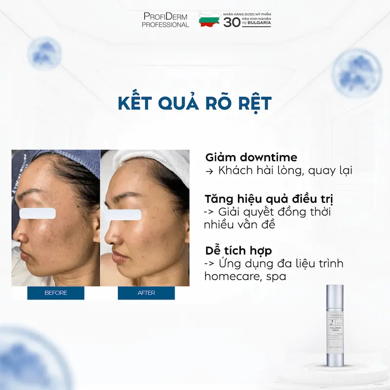 Các dòng sản phẩm nổi bật của Profiderm