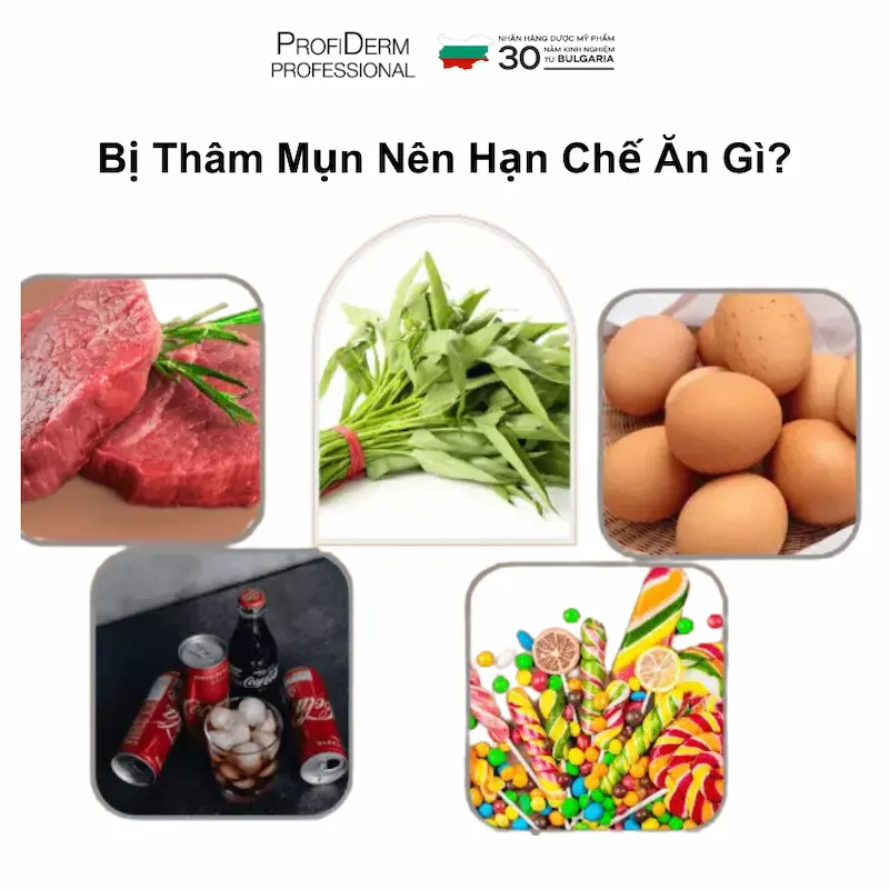 Bị Thâm Mụn Nên Hạn Chế Ăn Gì?