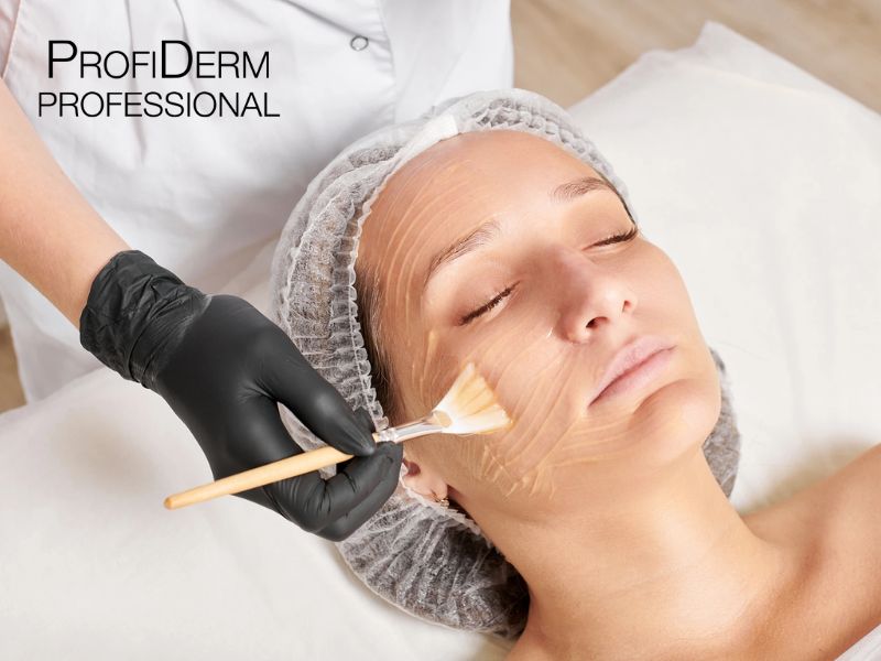 Peel Da Trị Thâm Mụn Là Gì? Tác Dụng Và Hiệu Quả Từ A-Z