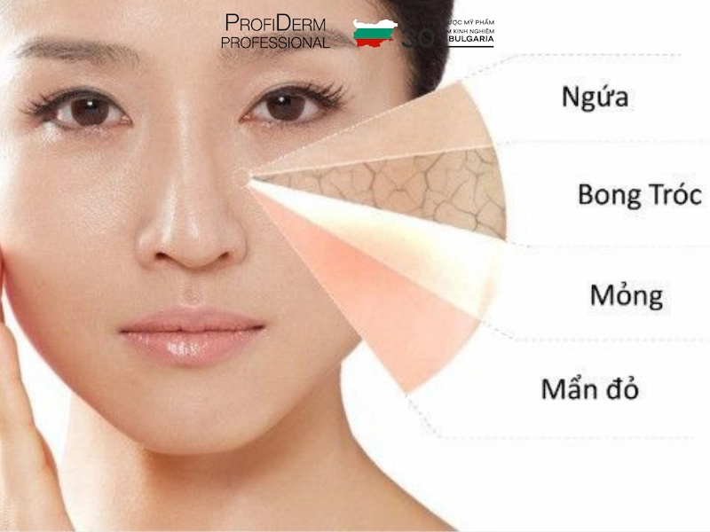 sửa rửa mặt cho da nhạy cảm sửa rửa mặt cho da nhạy cảm