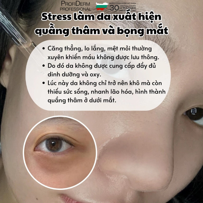 Tác hại của stress đối với làn da
