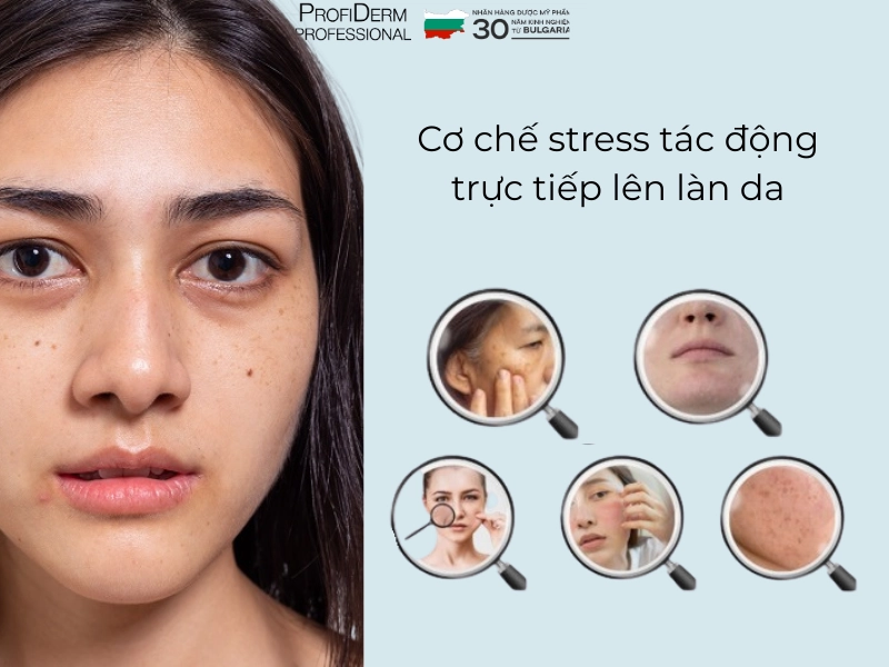 Tác hại của stress đối với làn da