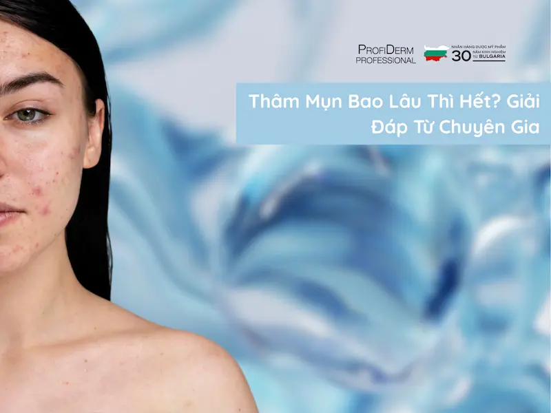 Thâm Mụn Bao Lâu Thì Hết? Giải Đáp Từ Chuyên Gia