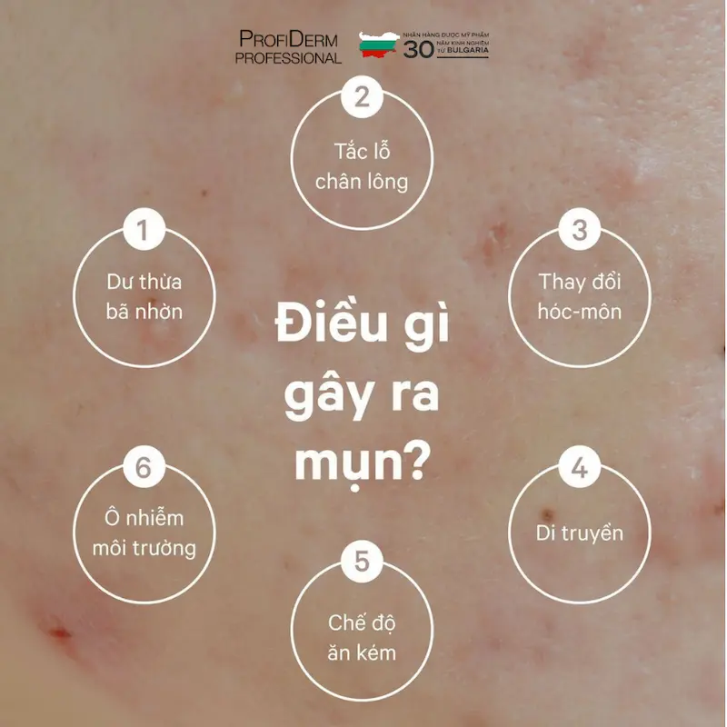 phục hồi da dầu mụn