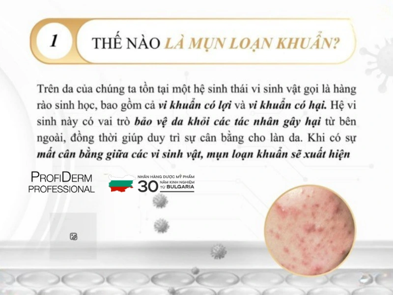 mụn loạn khuẩn