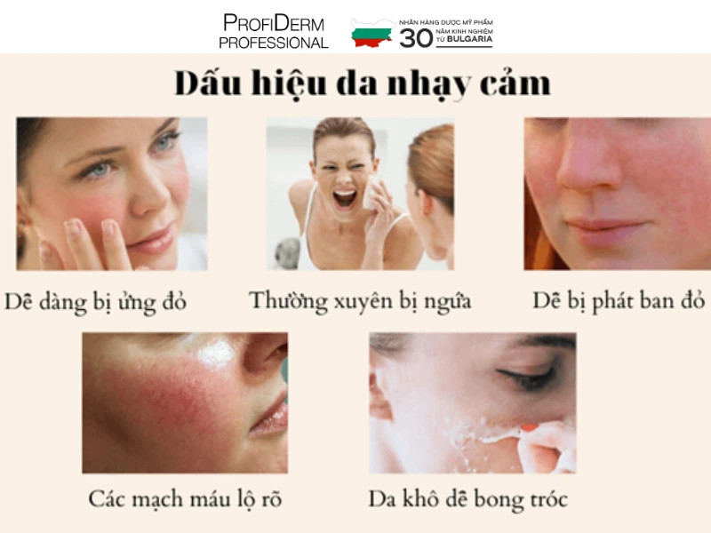 phân biệt da nhạy cảm và da bị dị ứng phân biệt da nhạy cảm và da bị dị ứng