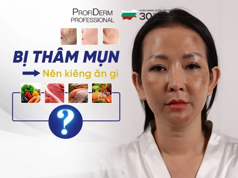 Các lưu ý khi trị thâm đỏ tại nhà Các lưu ý khi trị thâm đỏ tại nhà