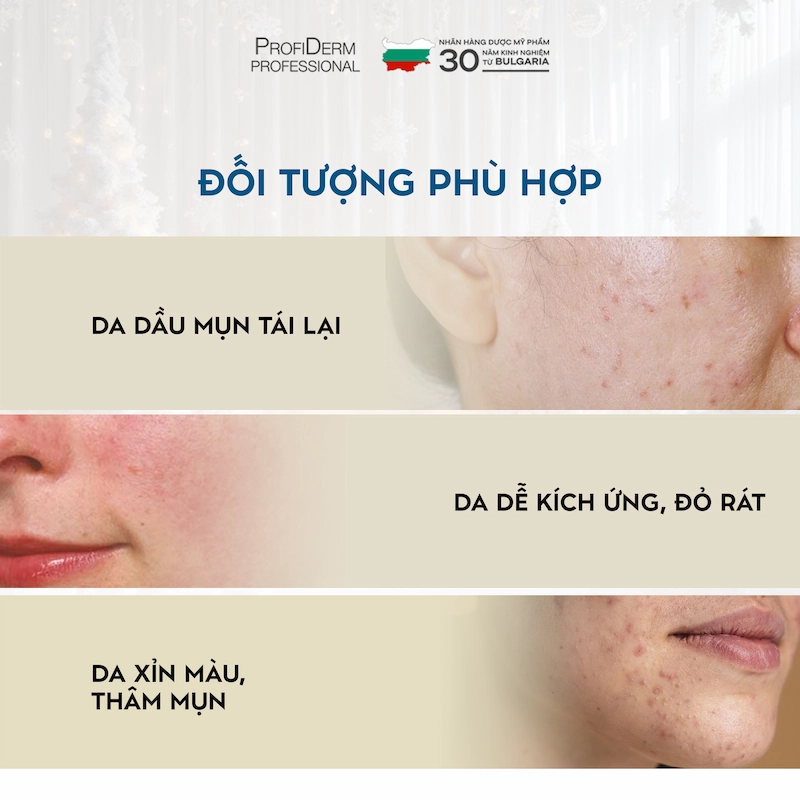 Profiderm Việt Nam – Giải pháp toàn diện cho làn da nhạy cảm mùa hè