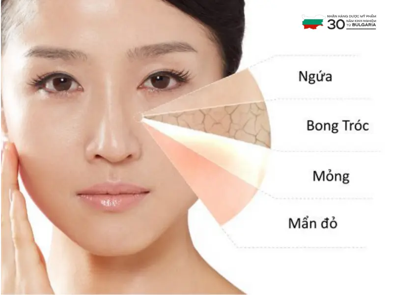 phục hồi da khô