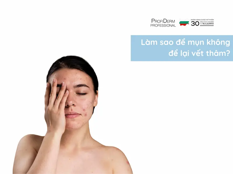 làm sao để mụn không để lại vết thâm