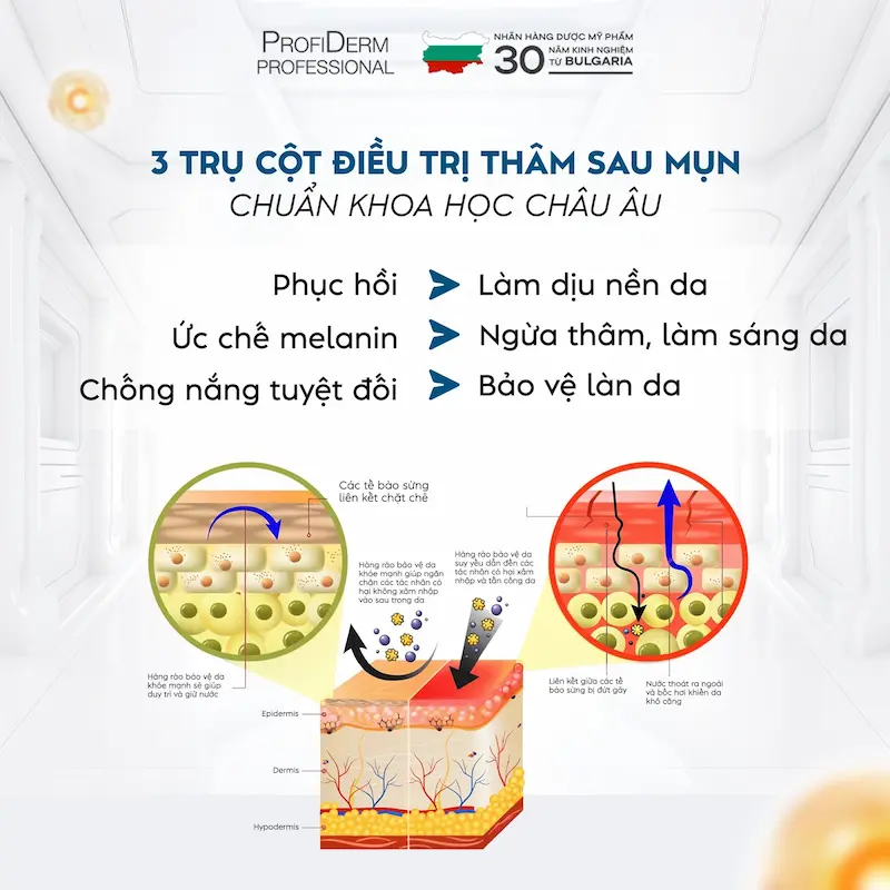 Lời khuyên từ chuyên gia Profiderm