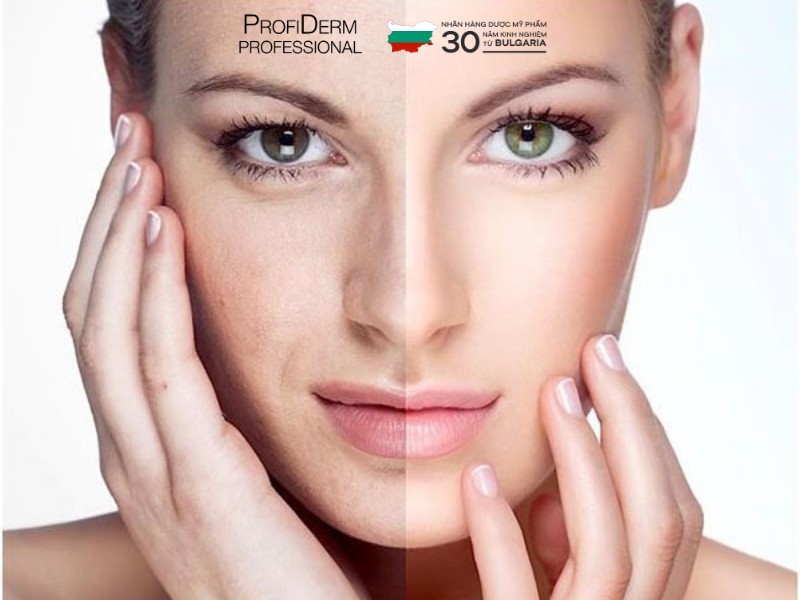 Lotion PHA: Giải Pháp Tẩy Tế Bào Chết Dịu Nhẹ Và Cấp Ẩm Chuyên Sâu