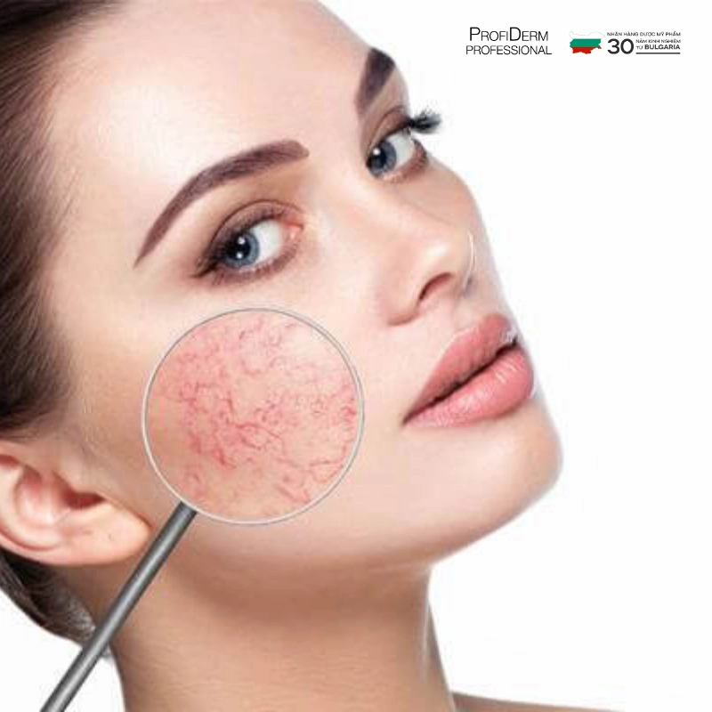 da khô nhạy cảm