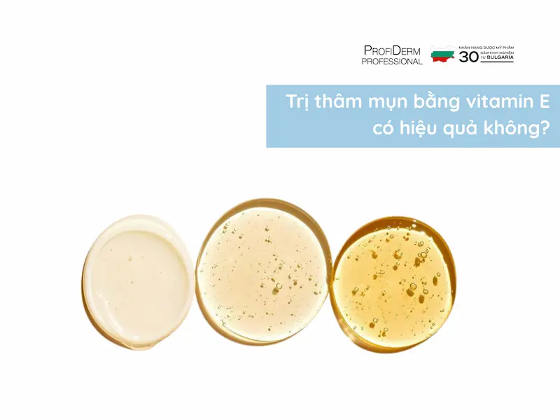 trị thâm mụn bằng vitamin e