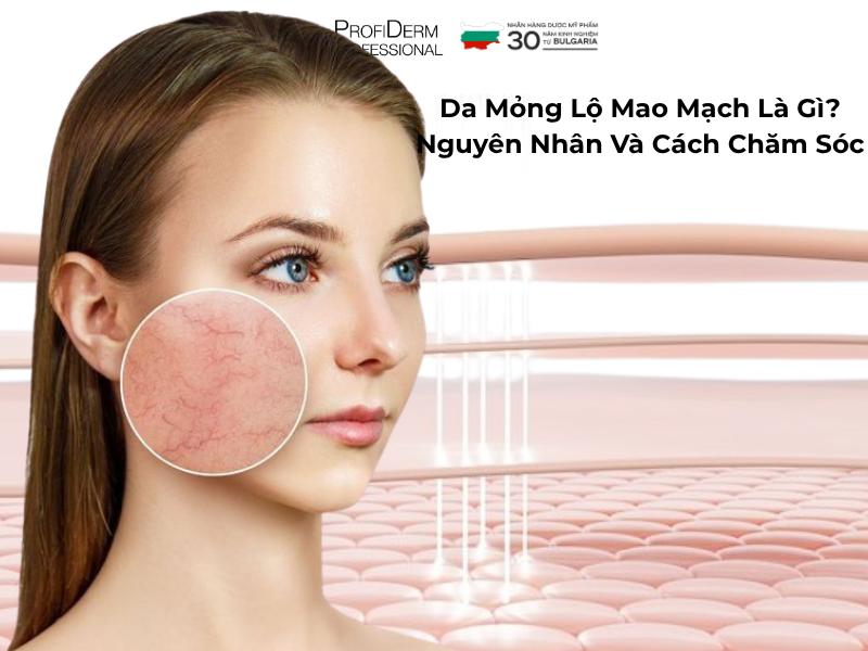 #Da Mỏng Lộ Mao Mạch Là Gì? Nguyên Nhân Và Cách Chăm Sóc