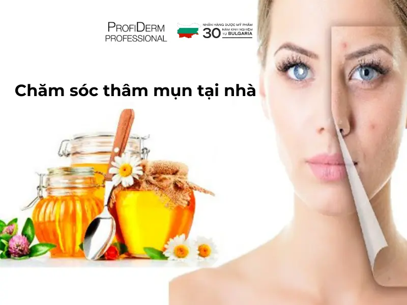 Giải pháp chuyên sâu giúp cải thiện vết thâm mụn