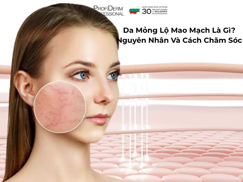 da mỏng lộ mao mạch