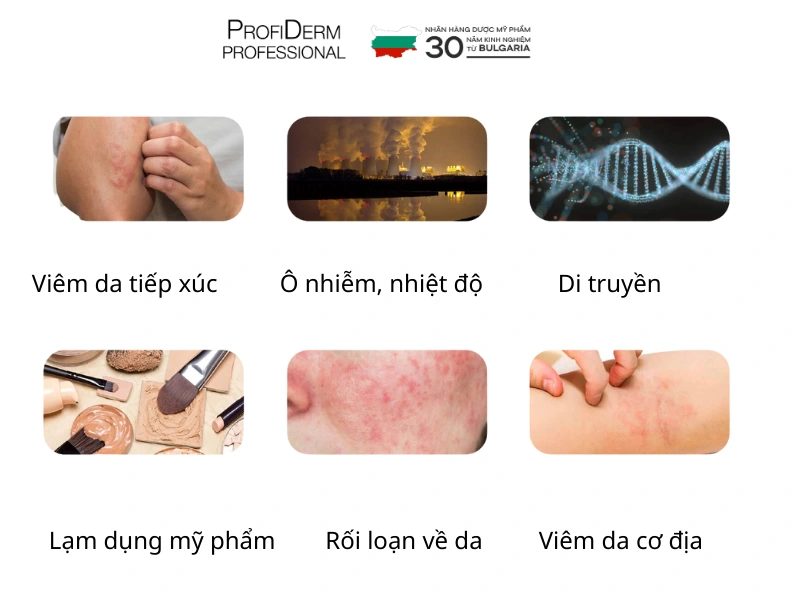 các bước chăm sóc da nhạy cảm