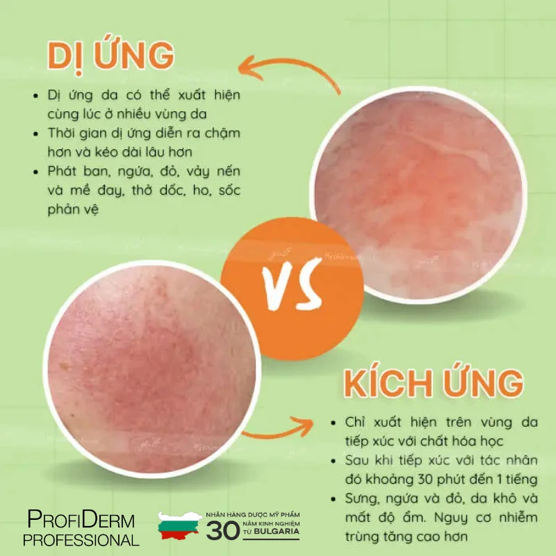 So sánh khác biệt giữa da nhạy cảm và da bị dị ứng So sánh khác biệt giữa da nhạy cảm và da bị dị ứng