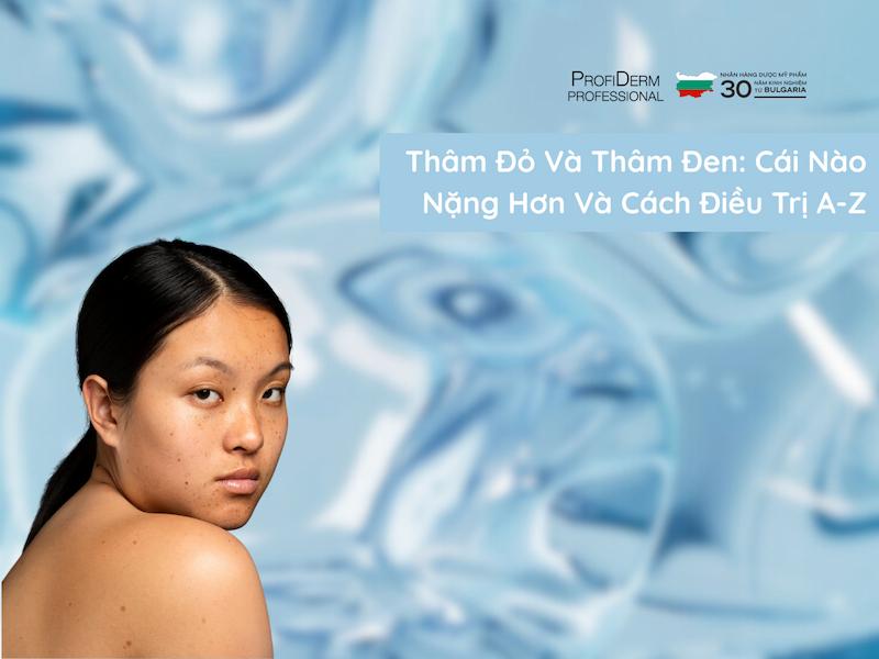 Thâm Đỏ Và Thâm Đen Cái Nào Nặng Hơn Và Cách Điều Trị A-Z