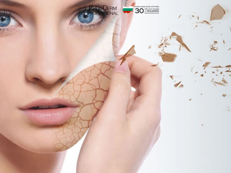 giãn mao mạch mặt giãn mao mạch mặt