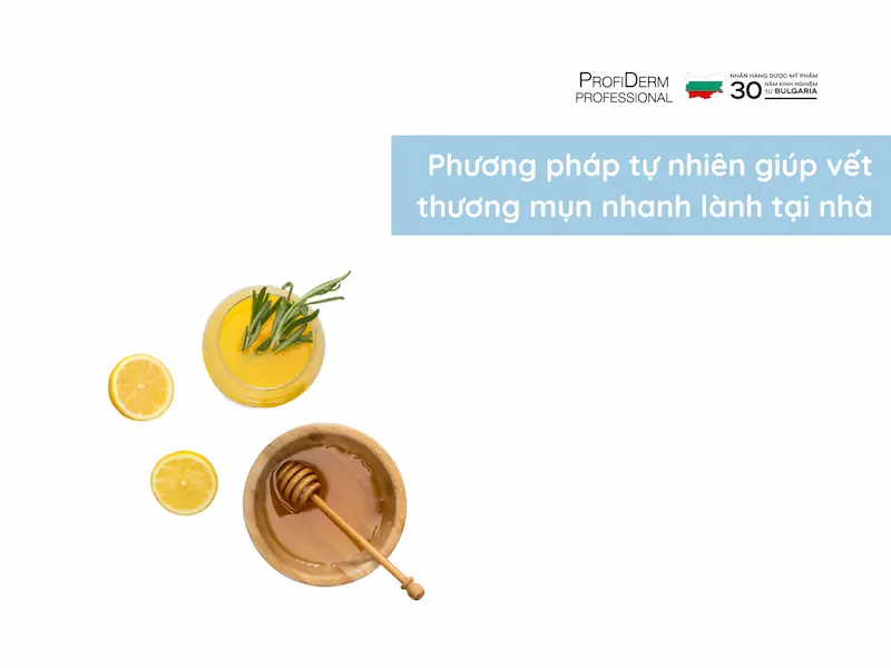 Phương pháp tự nhiên giúp vết thương mụn nhanh lành tại nhà