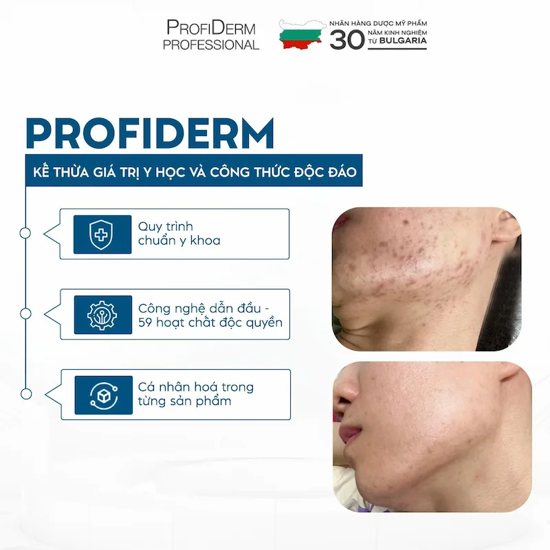 Triết lý chăm sóc da nhạy cảm của Profiderm Việt Nam Triết lý chăm sóc da nhạy cảm của Profiderm Việt Nam