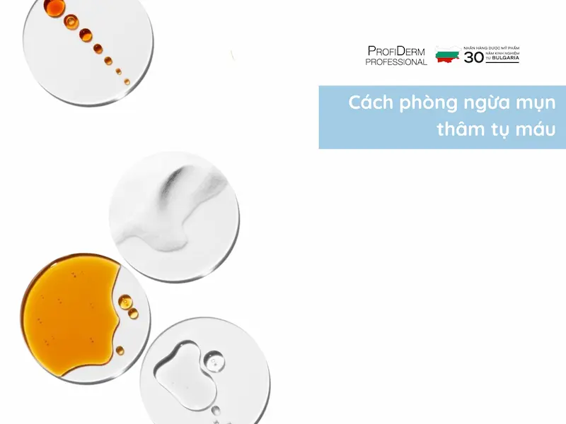 Cách phòng ngừa mụn thâm tụ máu