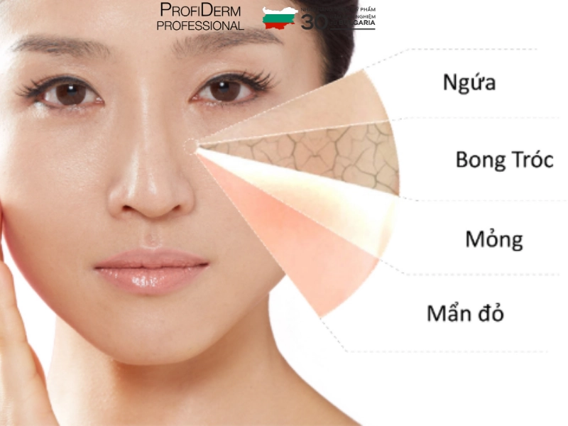 chăm sóc da nhạy cảm mùa hè