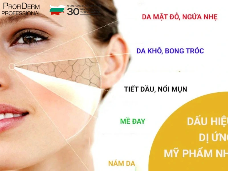 phân biệt da nhạy cảm và da bị dị ứng phân biệt da nhạy cảm và da bị dị ứng