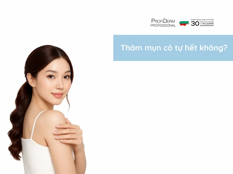 Thâm mụn có tự hết không?  