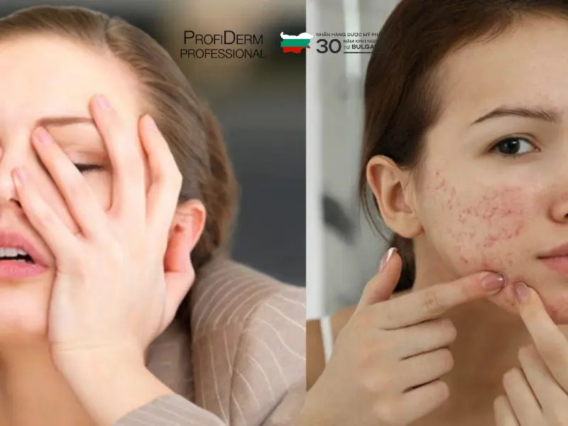 vitamin c có trị thâm không