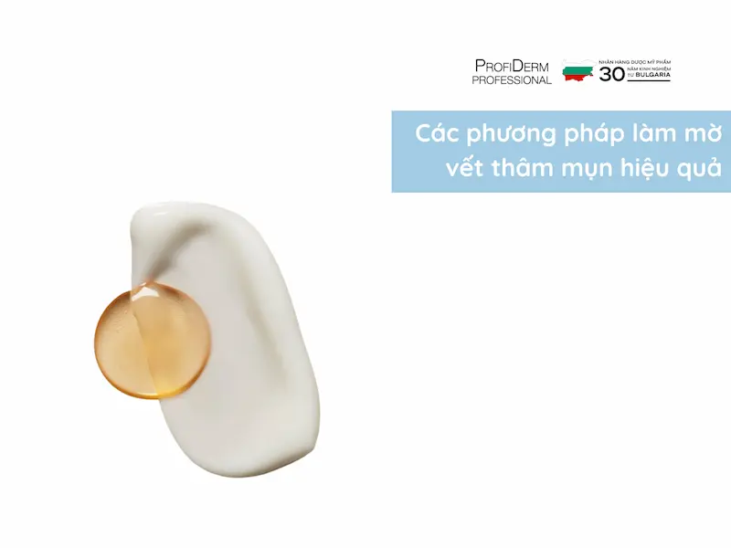 Các phương pháp làm mờ vết thâm mụn hiệu quả