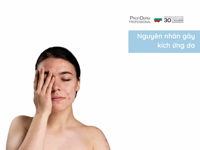 Top 7 Bước Phục Hồi Da Bị Kích Ứng Cấp Tốc Tại Nhà