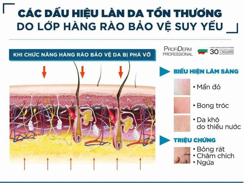 phục hồi da bị bào mòn