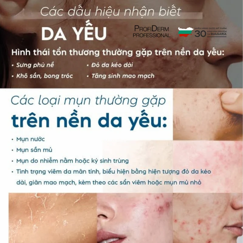 kem chống nắng cho da nhạy cảm