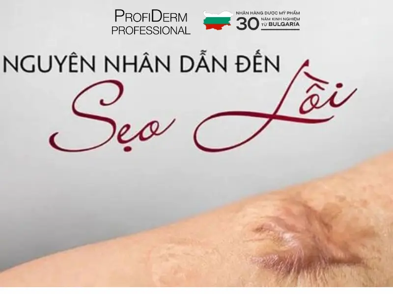các loại thâm mụn