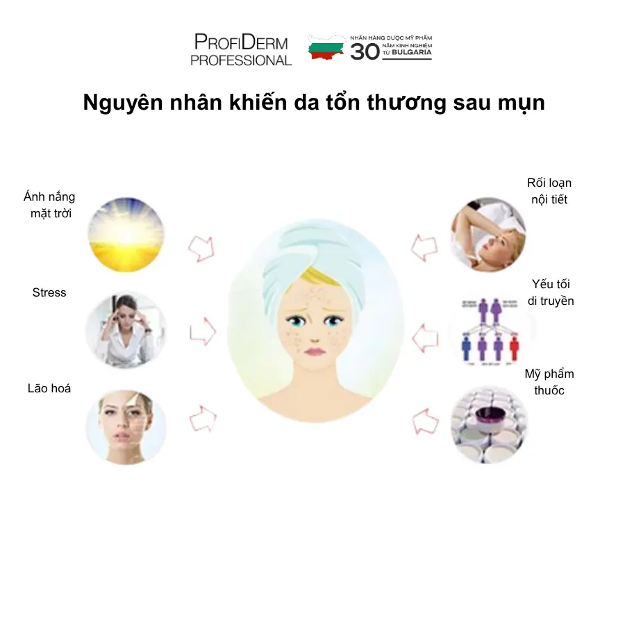 phục hồi da mụn