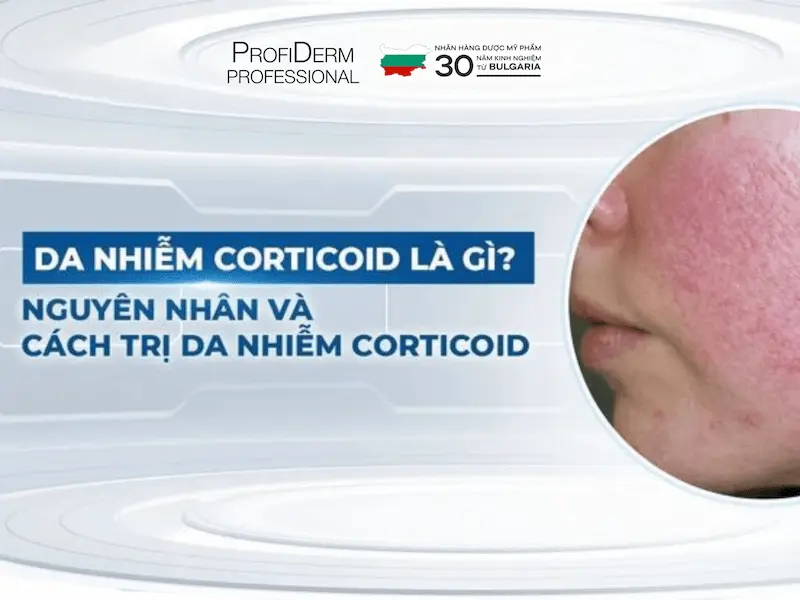 phục hồi da nhiễm corticoid