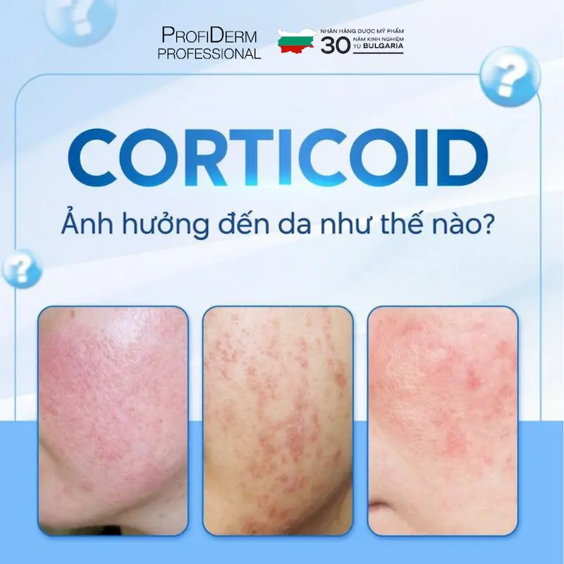 da mỏng lộ mao mạch