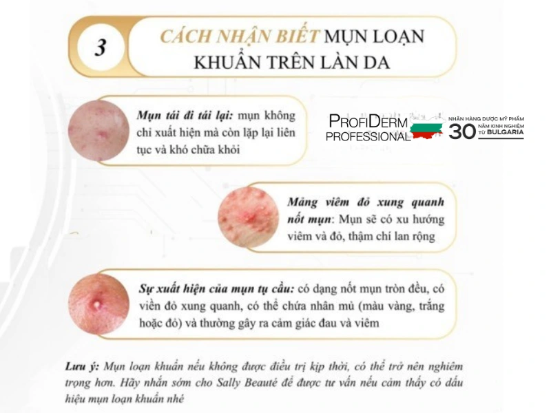 mụn loạn khuẩn