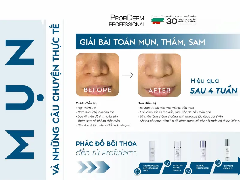 vitamin c có trị thâm không