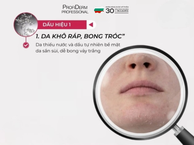 Tác hại của stress đối với làn da